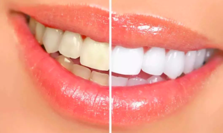 natural-ways-methods-to-whiten-teeth